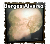 Berg&eacute;s Alvarez